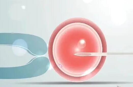 特纳综合征可以移植卵巢吗，可以做试管吗