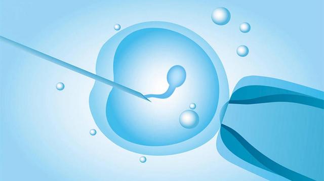 多囊巢适合做成都第三代试管婴儿吗
