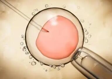 为什么胚胎着床会失败，选对试管婴儿医的重要性